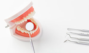 梅の木歯科クリニックの一般歯科